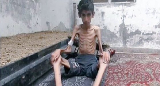 Mueren 23 personas de hambre en Siria