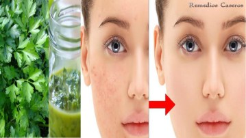 COMO QUITAR LAS MANCHAS Y ARRUGAS DE TU CARA