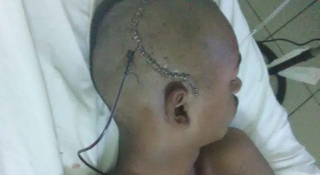 EN COMA, MENOR EMBESTIDO POR  MOTORISTA