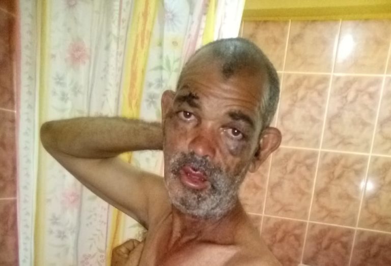 ENCUENTRAN VIVO DISCAPACITADO MENTAL