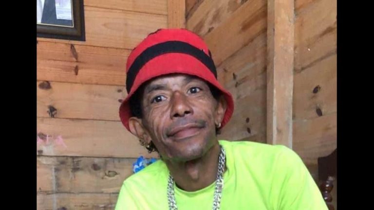 Fallece  hombre  fue quemado por su pareja mientras dormía