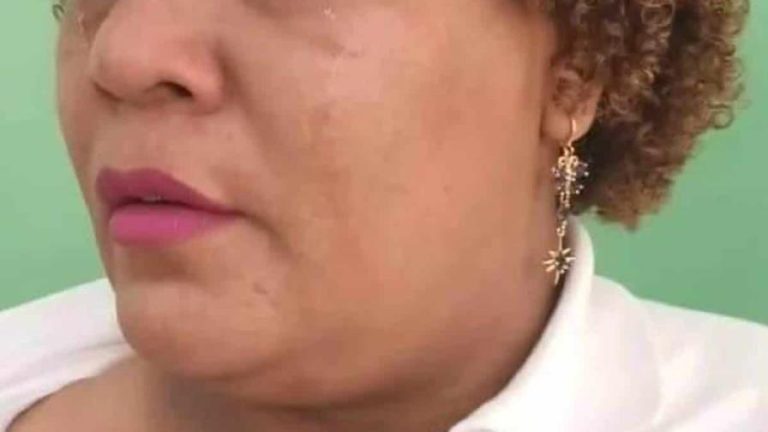 Enajenado mental entra a escuela  y agrede a una maestra